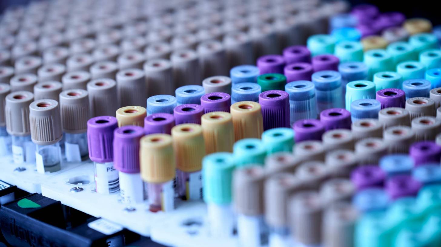 vials of blood waiting on covid testing