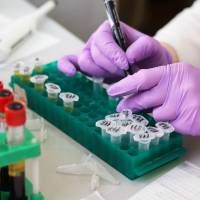 medical lab with specimaens testing