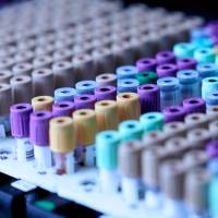 vials of blood waiting on covid testing