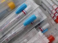 swab tests